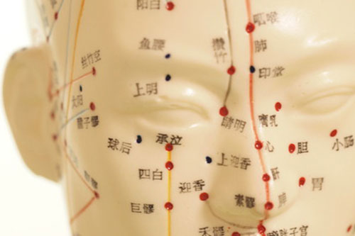 鍼灸治療